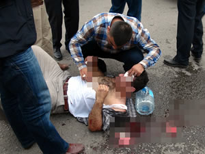 Yol verme kavgası yüzünden hastanelik oldu!