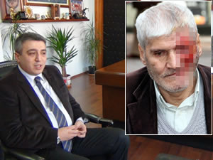 Yüz nakli bekleyen adama devlet eli